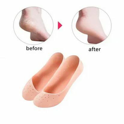 Anti crack silicone socks